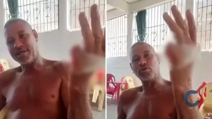 Baiano viraliza após aparecer com dedo mindinho cortado e citar vitória de Lula